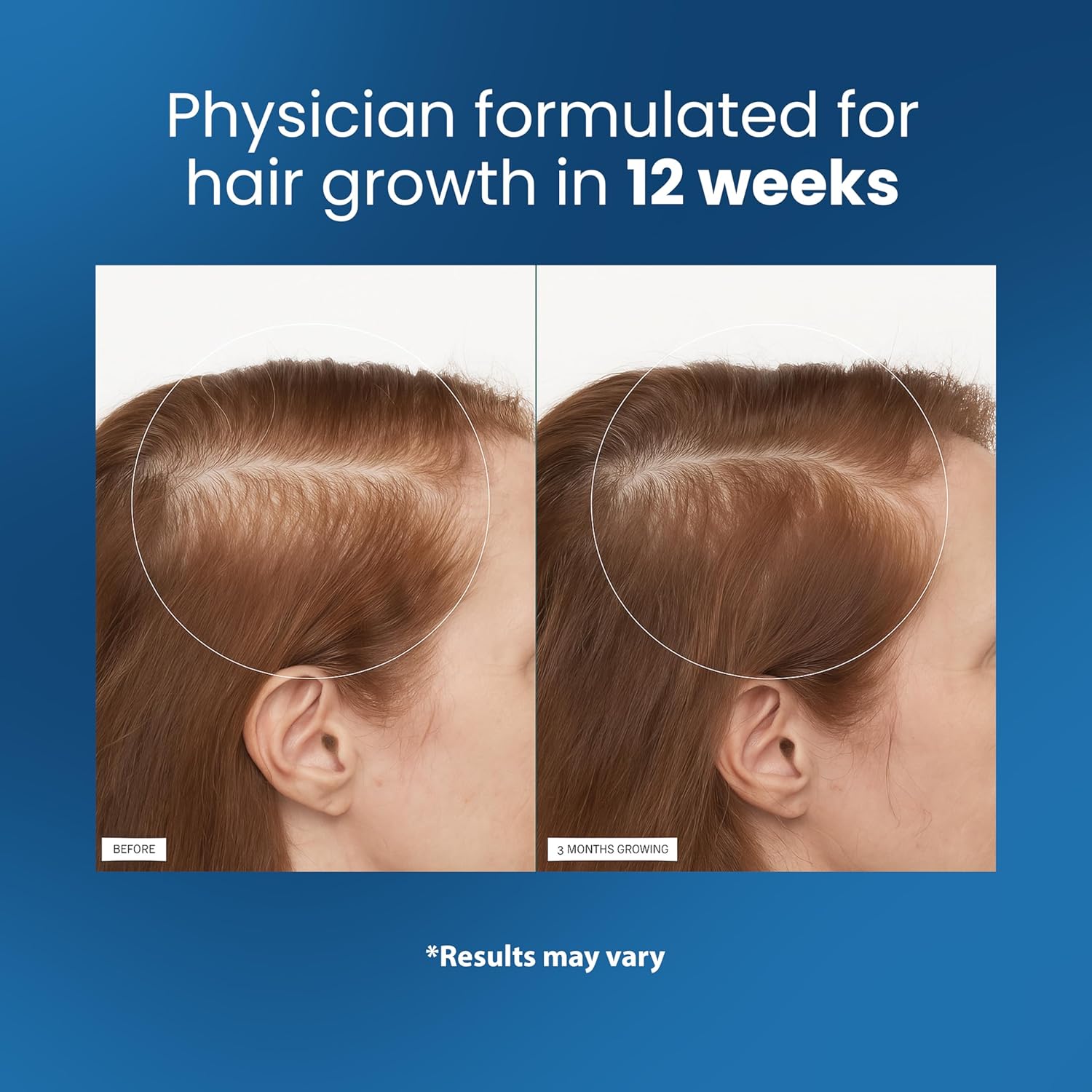 Revive Your Confidence with Thicker, Healthier Hair