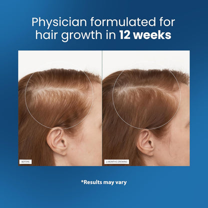 Revitalize Hair Growth Roll-On™